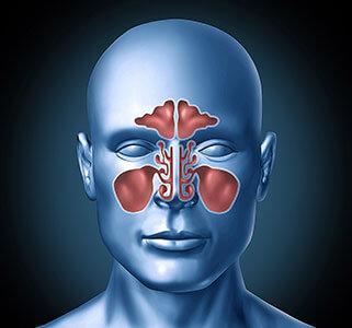 Untersuchungen bei Problemen der Nasennebenhöhlen beim Radiologen: Illustration des Kopfes und der Nasennebenhöhlen