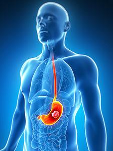 Radiologische Untersuchungen Innere Organe radiologische Praxis