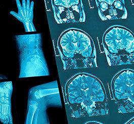 MRT und CT Untersuchungen Bild aus einem radiologischen Diagnosegerätes der Radiologie in Föhren