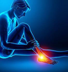 Untersuchung Fuß und Sprunggelenk — Radiologische Untersuchungen, Schmerzen im Fußgelenk